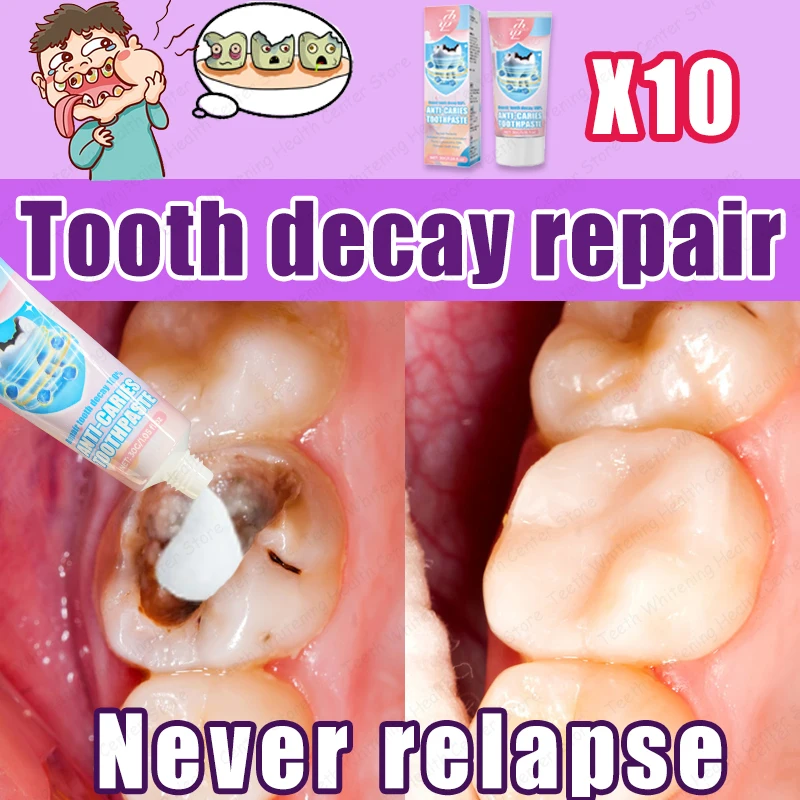 99 9% Teknik sazi azi אור