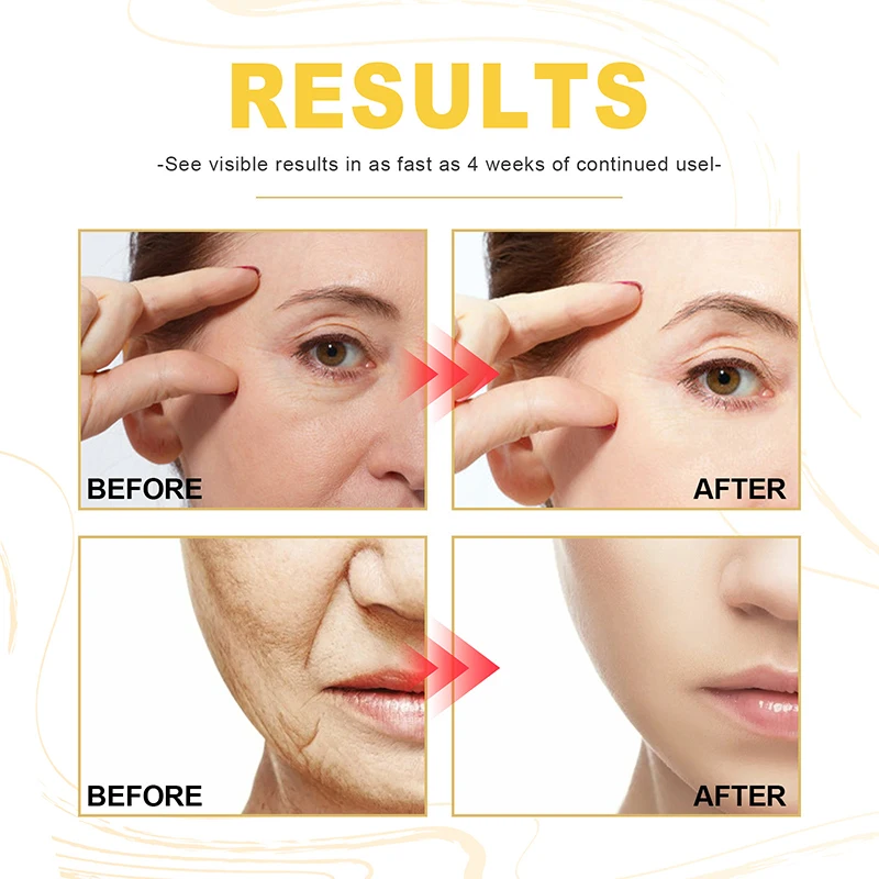 Рисунок 3 - Антиморщинистый крем