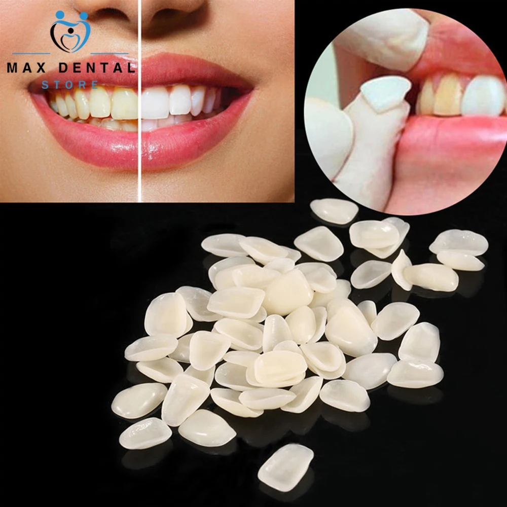 Зубные виниры для зубов временная корона ультратонкая смола стоматологии защита