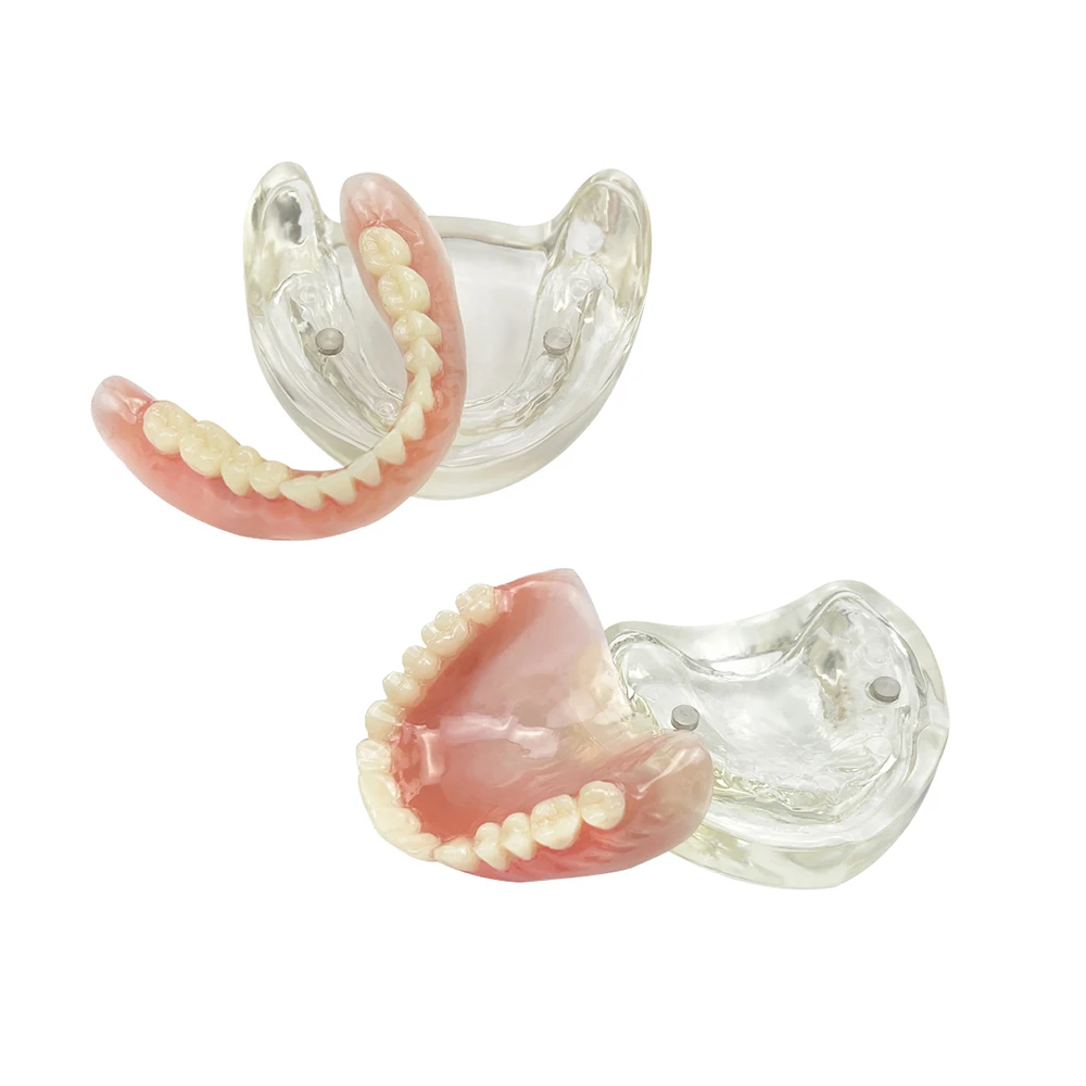 1 комплект съемный адсорбционный зуб для зубного имплантата верхняя нижняя часть