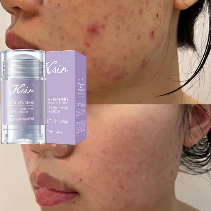 

Blackhead Cleaning Mask Moisturizing Oil Control Deep Cleansing Shrink Pores Acne Treatment Solid Face Mask Stick Skin Care 40g