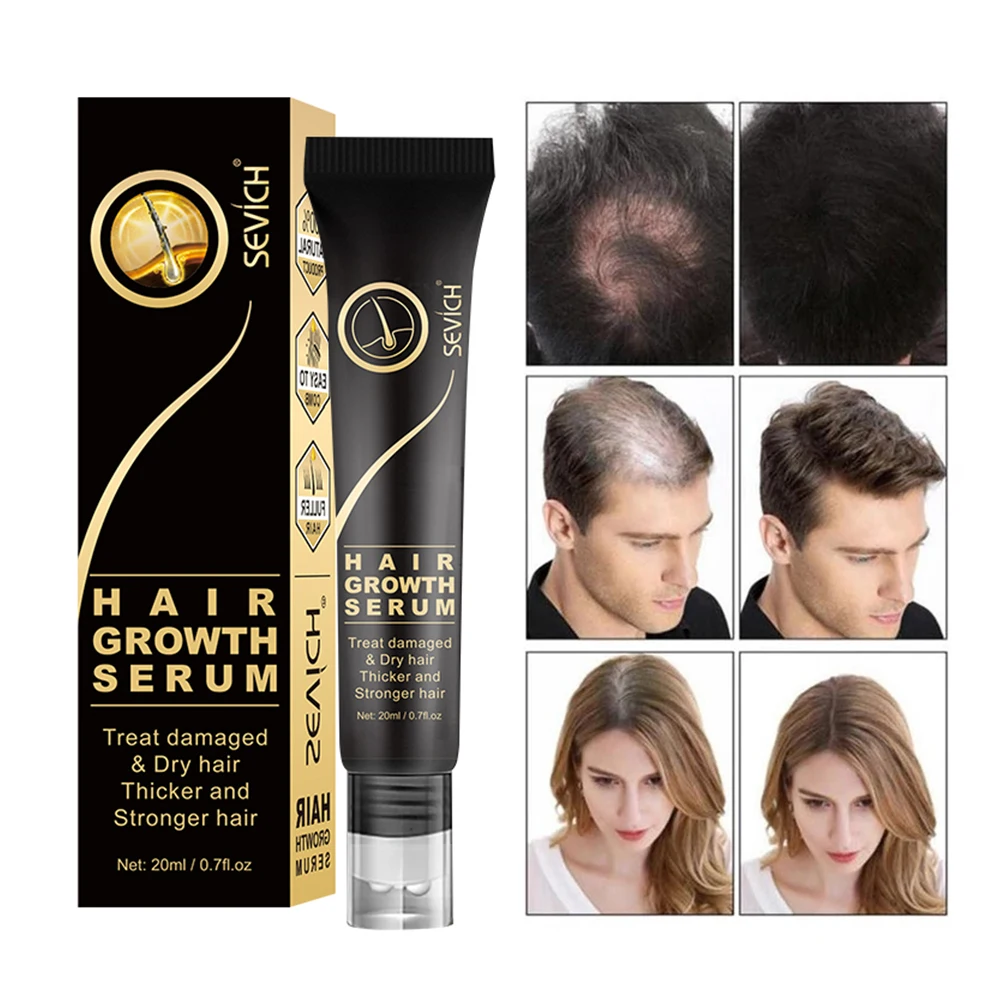 

Hair Growth Oil Ginger Extract Growing Serum Prevent Hair Loss Care Scalp Massage Roller Treatment Thickener Essence 20ml