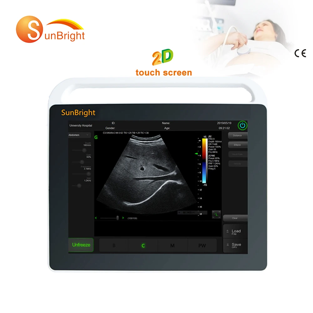 

Sunbright cheap touch screen 2D portable ecografo ultrasound machine price