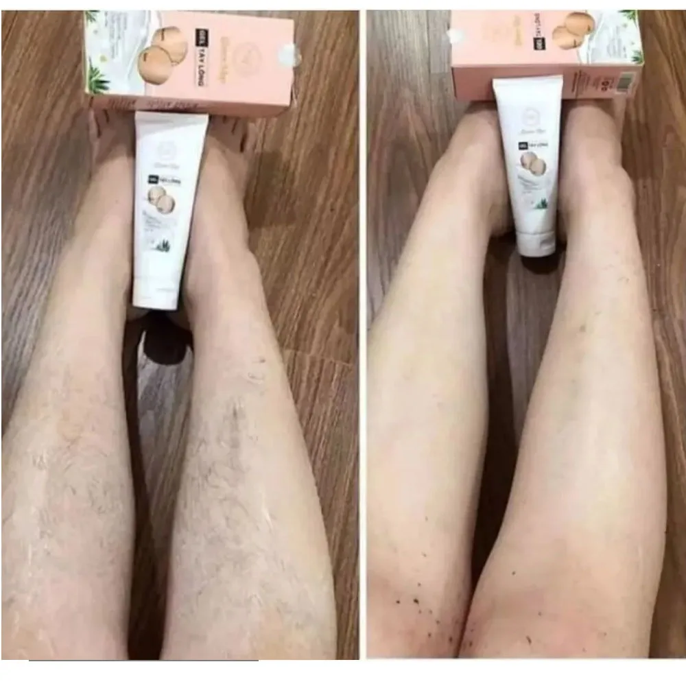 Kem Tay Long Tang сыворотка Cao Triet долгое безболезненное мягкое удаление волос для тела