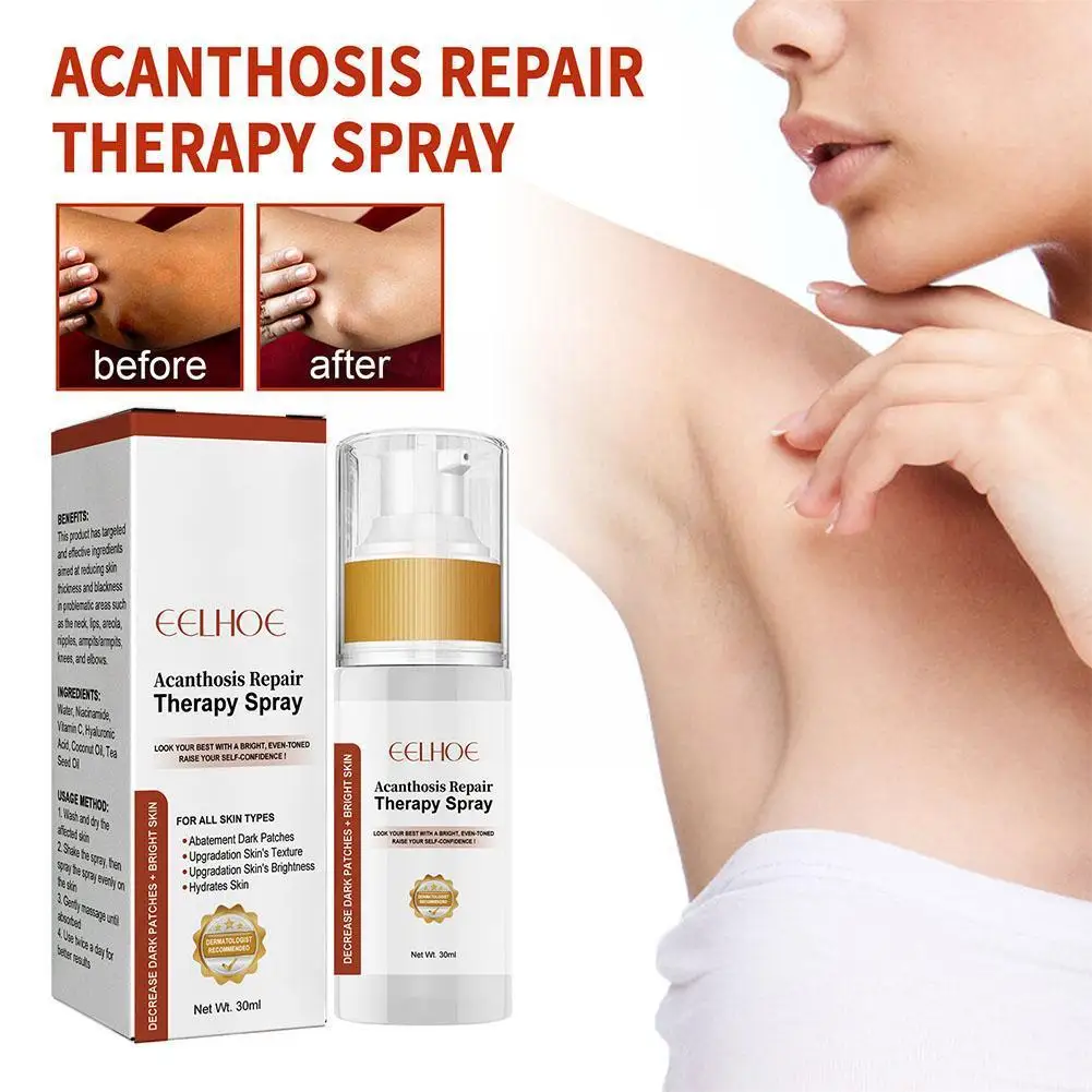 

30ml Acanthosis Repair Therapy Spray Fungicidal Feet Foot Itching Foot Pedicure Sweat Odor Peeling Foot Athlete Care Care G6W4
