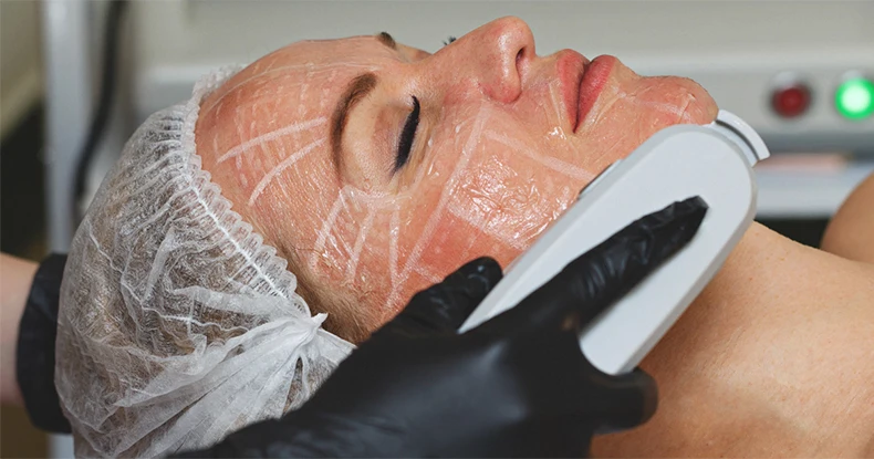 Professional beauty salon remove facial wrinkles and facial skin care machine Professional beauty salon remove facial wrinkles enlarge