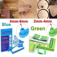 skin tag removal kit papillomas treatment skin cleansing tools micro band 4 6mm for berrugas warts remove mole wart face care