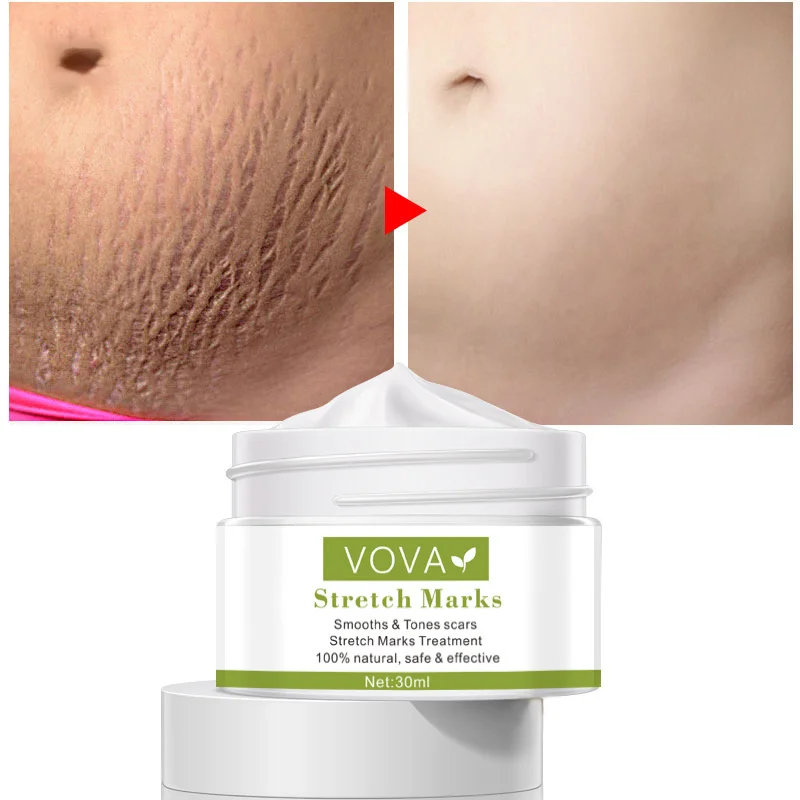 

VOVA Stretch Marks Repair Cream Remove Pregnancy Stretch Marks Treatment Scar Fades Fine Lines Lift Firm Nourish Body Skin Cream