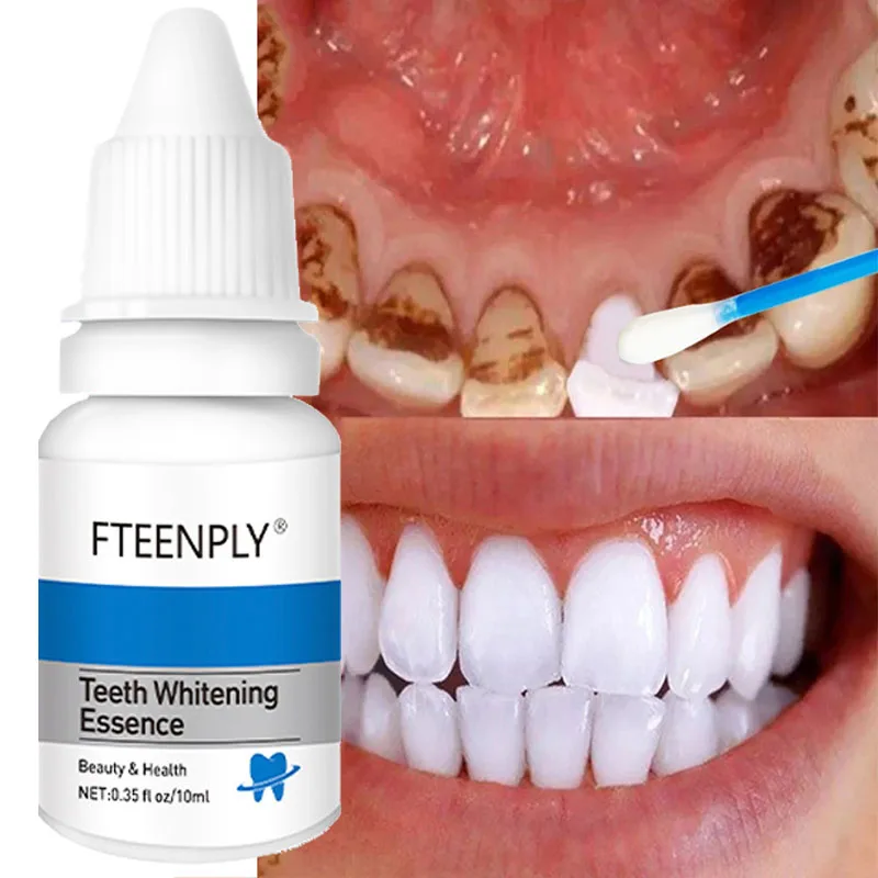 Teeth Whitening Essence Remove Plaque Smoke Stain Cleaning Oral Hygiene Products Fresh Breath Bleaching Dental Beauty Care Tools