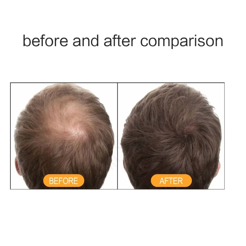 100 мл имбирный шампунь и кондиционер с имбирным шампунем для ухода за волосами