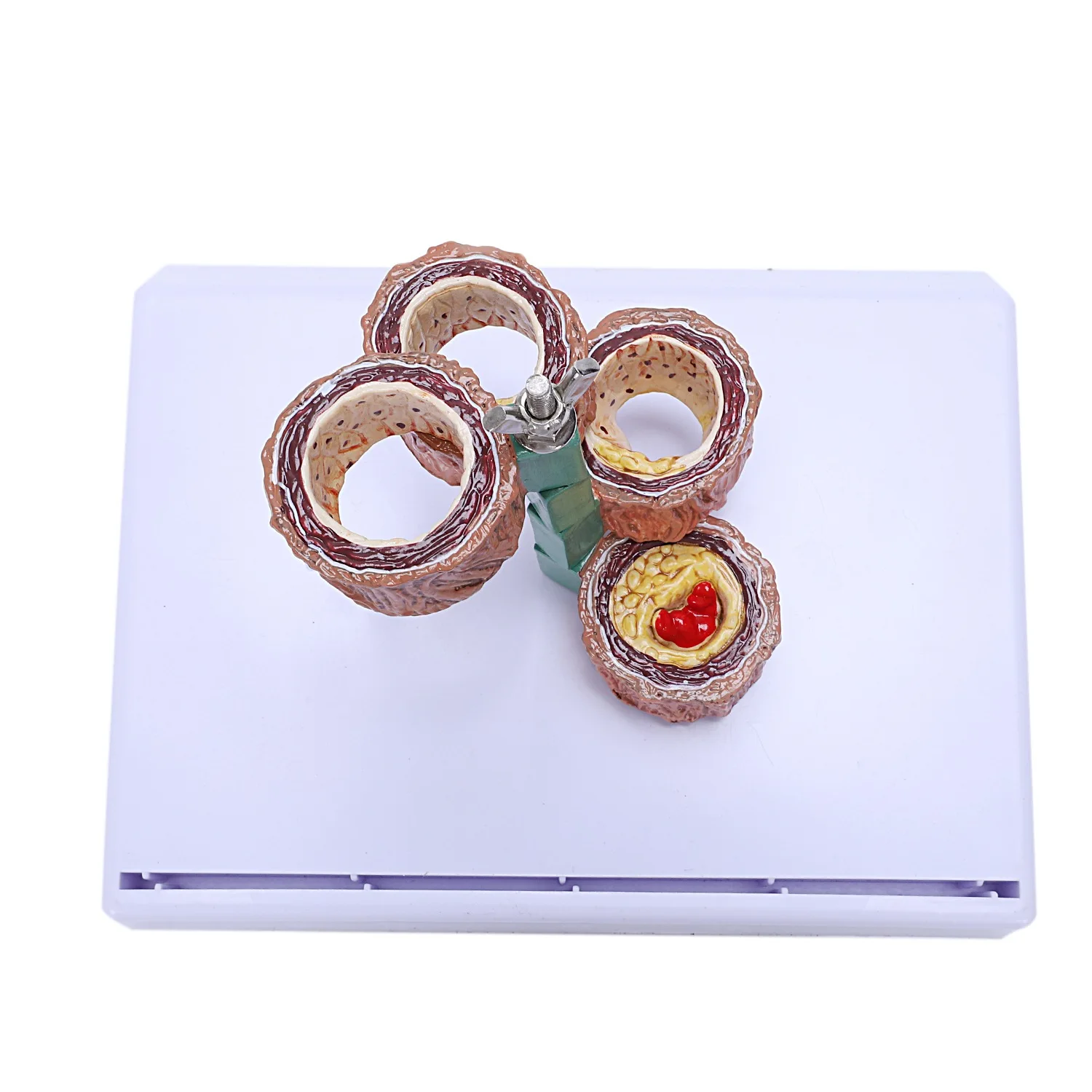 Модель тромбоза атеросклероза демонстрация сосудистых заболеваний модель