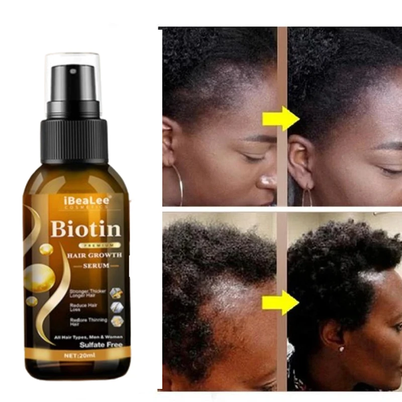 

iBeaLee Hair Growth Products Biotin Fast Growing Hair Care Essential Oils Anti Hair Loss Spray Scalp Treatment For Men Women