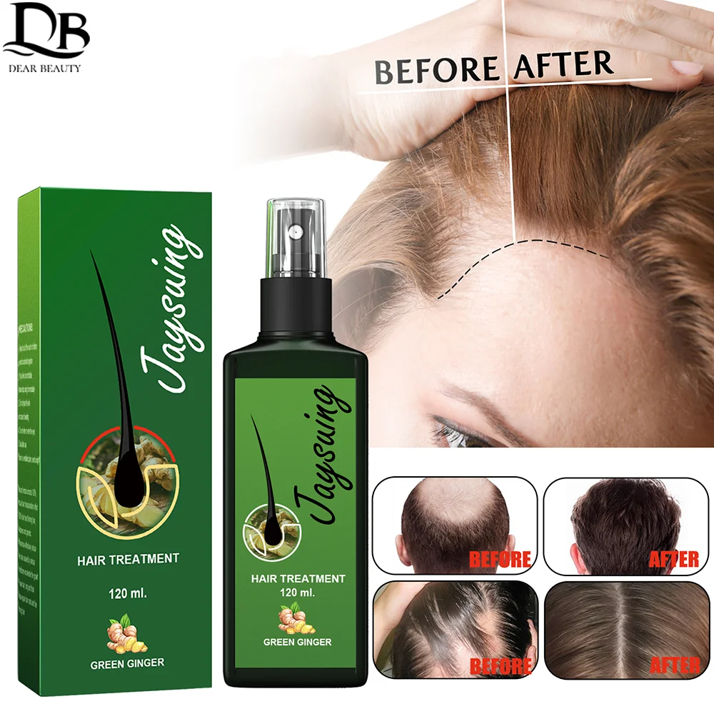 

120ml Hair Growth Spray Natural Ginger Hair Growth Oil Haircare Anti Hair Loss Hair Lotion Baldness Repair Spray For Hair Growth