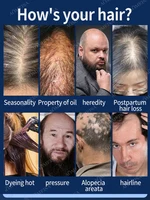 Fast Hair Growth Hair Follicle Treatment Hair Growth Seborrheic Alopecia Hairline Upward Postpartum Hair Loss Baldness Hair Loss 2