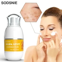 dark spot corrector intense freckle cream whitening fade removal melasma sun spot moisturizing brightening skincare beauty 40g