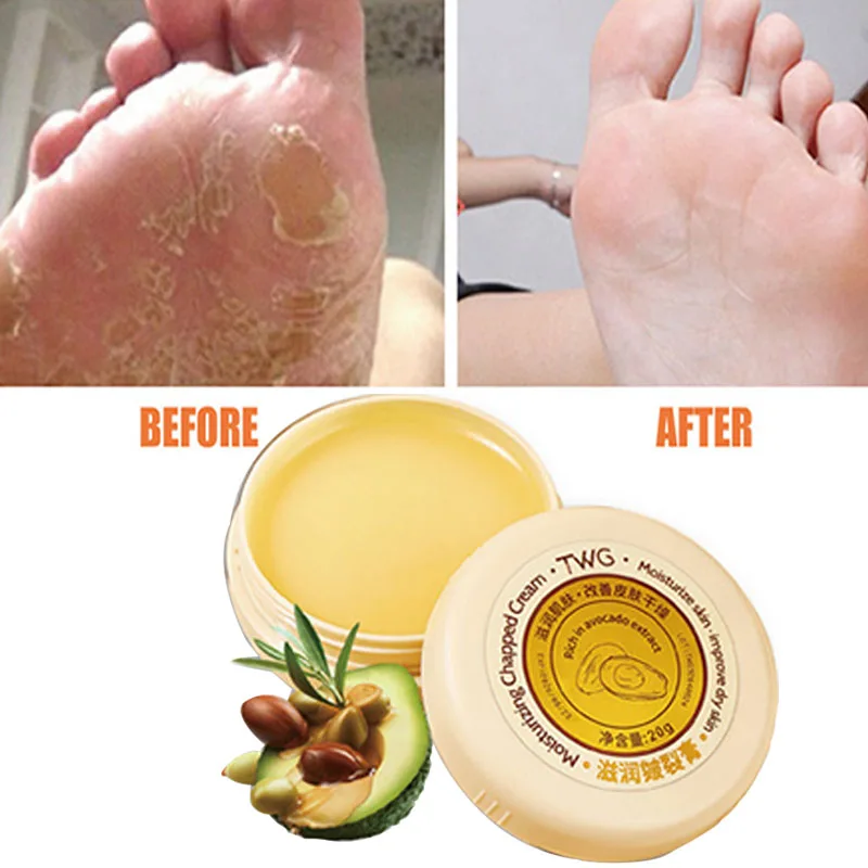 Herbal Feet Heel Repair Oil Anti-drying Remove Callus Dead Skin Balm Hand Foot Nourishing Body Care