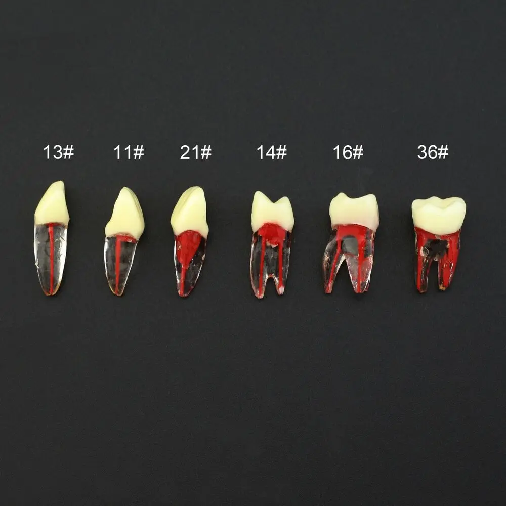 Kilgore Nissin Type Dental Endo Practice Teeth Anatomical Pulp Cavity Root Model