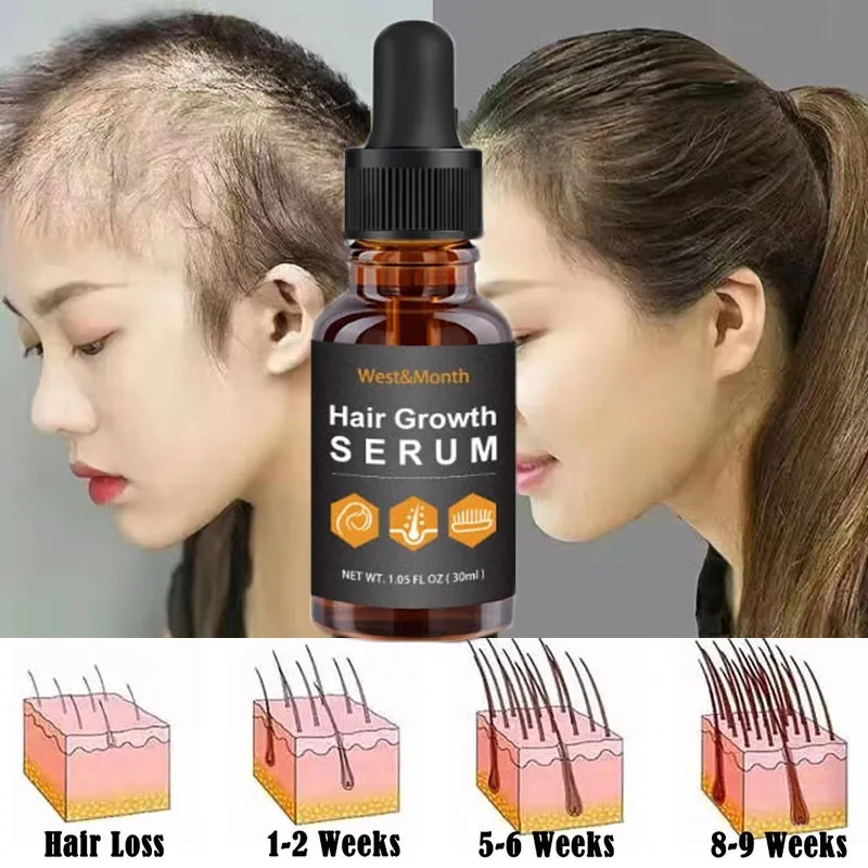 

Fast Hair Growth Oil Ginger Anti Hair Break Regrowth Essence Strengthener Hair Prevent Loss Treatment Damaged Scalp Products