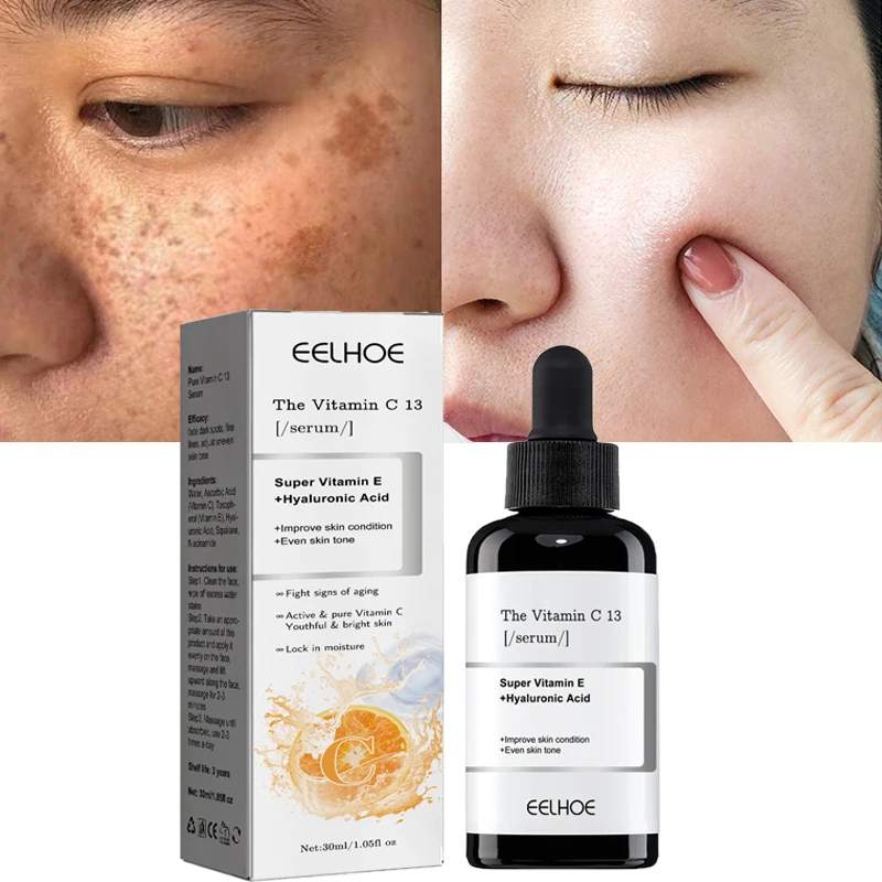 Vitamin C Whitening Freckles Face Serum Remove Dark Spot Fade Melasma Anti-Aging Brightening Moisturizer Essence Toner Skin Care