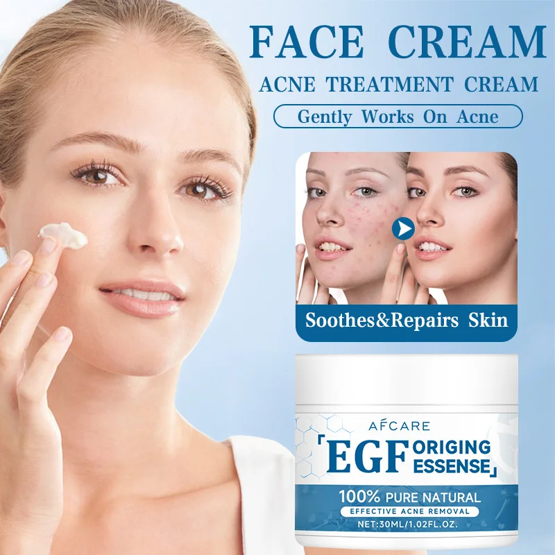 Крем для лечения акне с олигопептидами средство восстановления прыщей глубокой