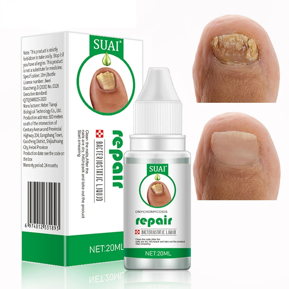 

Nail Treatments Essence Feet Care Serum Nails Fungus Foot Toe Fungal Removal Gel Anti Infection Paronychia Onychomycosis Repair