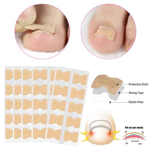 10/20/50 Pcs Nail Correction Stickers Ingrown Toenail Corrector Patches Paronychia Treatment Recover