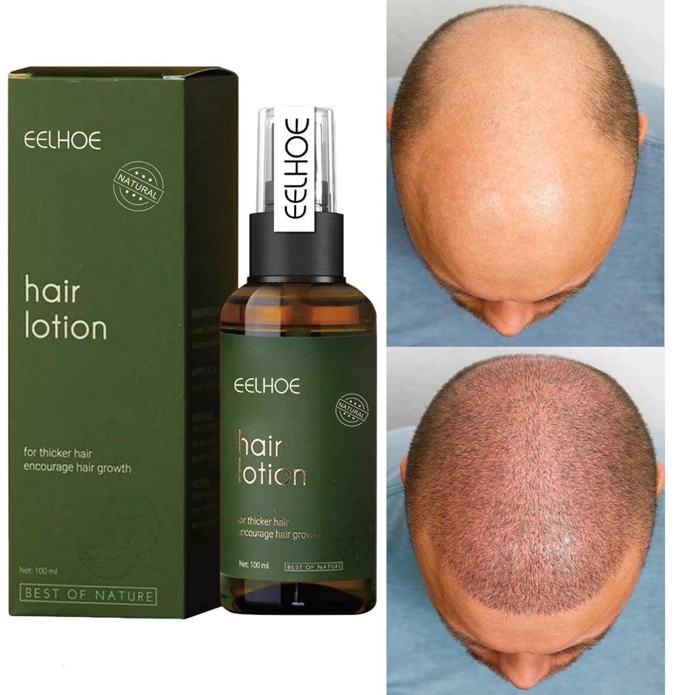 

Спрей для роста волос для мужчин и женщин, биотин, для быстрого ухода за волосами, для восстановления и ухода за волосами