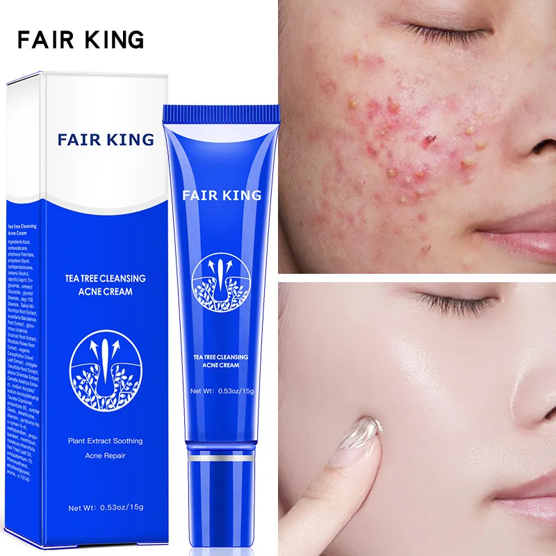 Herbal Acne Removal Face Cream Fade Pimple Spots Shrink Pores Anti-Acne Treatment Tea Tree Gel Oil Control Moisturizer Skin Care