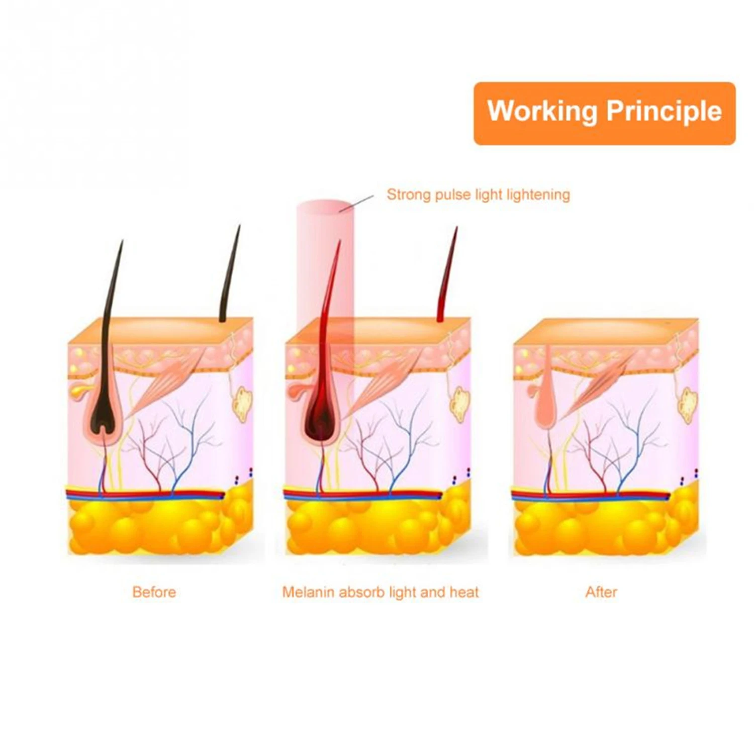 IPL Device Hair Removal Epilator for Women 500000 Flashes Epilator Hair Remover Shaving Machine Facial Epilator Women's Shaver