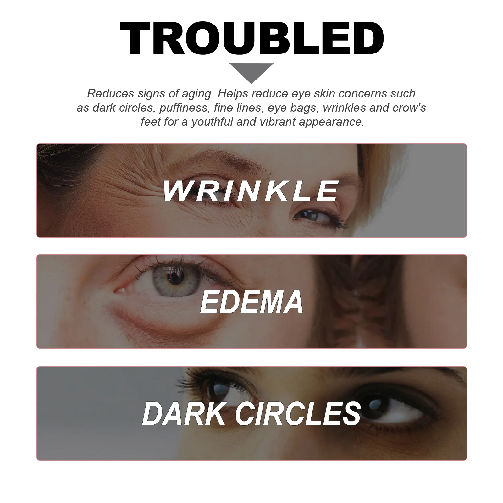 Никотинамид крем для кожи вокруг глаз устранение темных кругов и припухлости