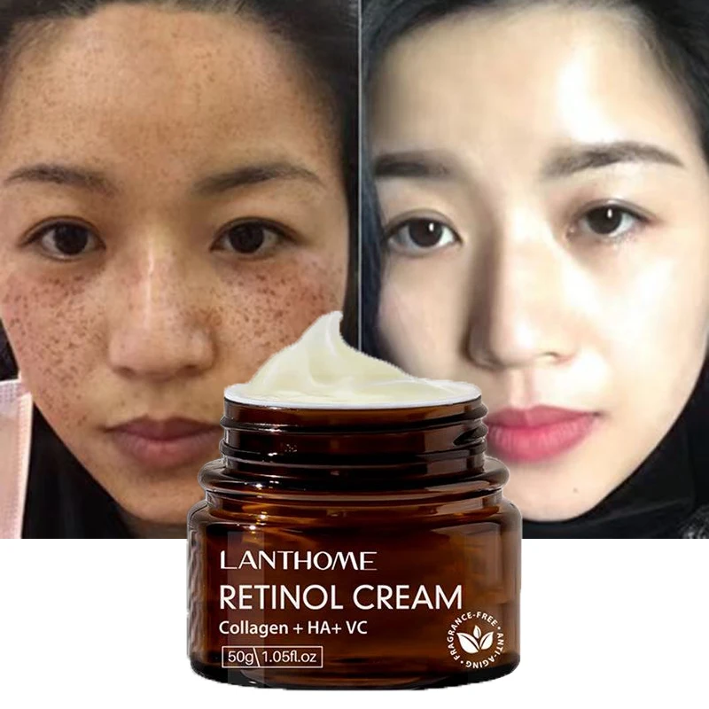 

Средство для ухода за кожей лица, от акне и черных точек