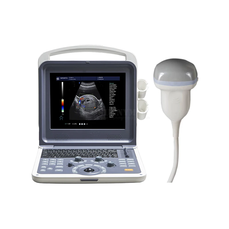 SY-A042N Medical  portable kidney ultrasound 4D color doppler ultrasound