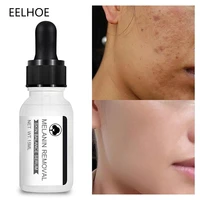 whitening remove freckle face serum fade dark spots melasma brighten moisturizer acne treatment facial essence skin care