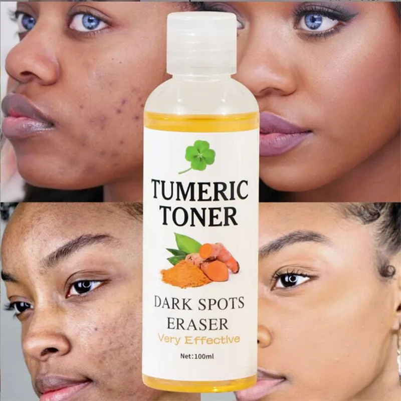 

Turmeric Facial Toner Anti Aging Acne Dark Spot Removal Whitening Face Serum Ginger Moisturizing Skin Brighten Essential Liquid