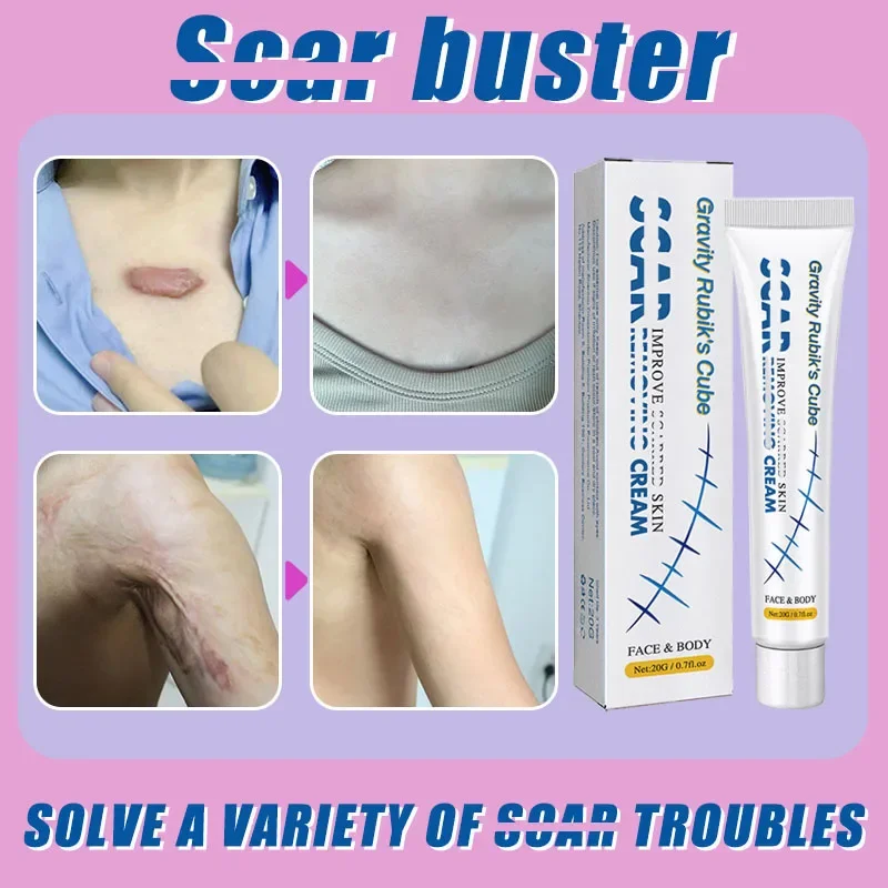 Ремешок для удаления циклозы цезария эстрия циклические круги эскалация зоны