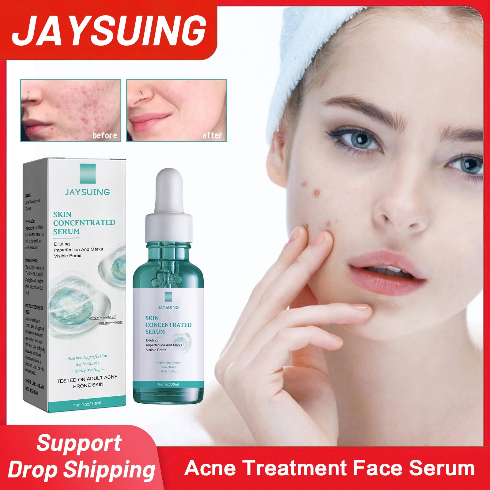 

Acne Treatment Face Serum Fade Acne Marks Against Acne Remove Pimple Oil Control Anti Inflammatory Pores Shrinking Essence 30ml