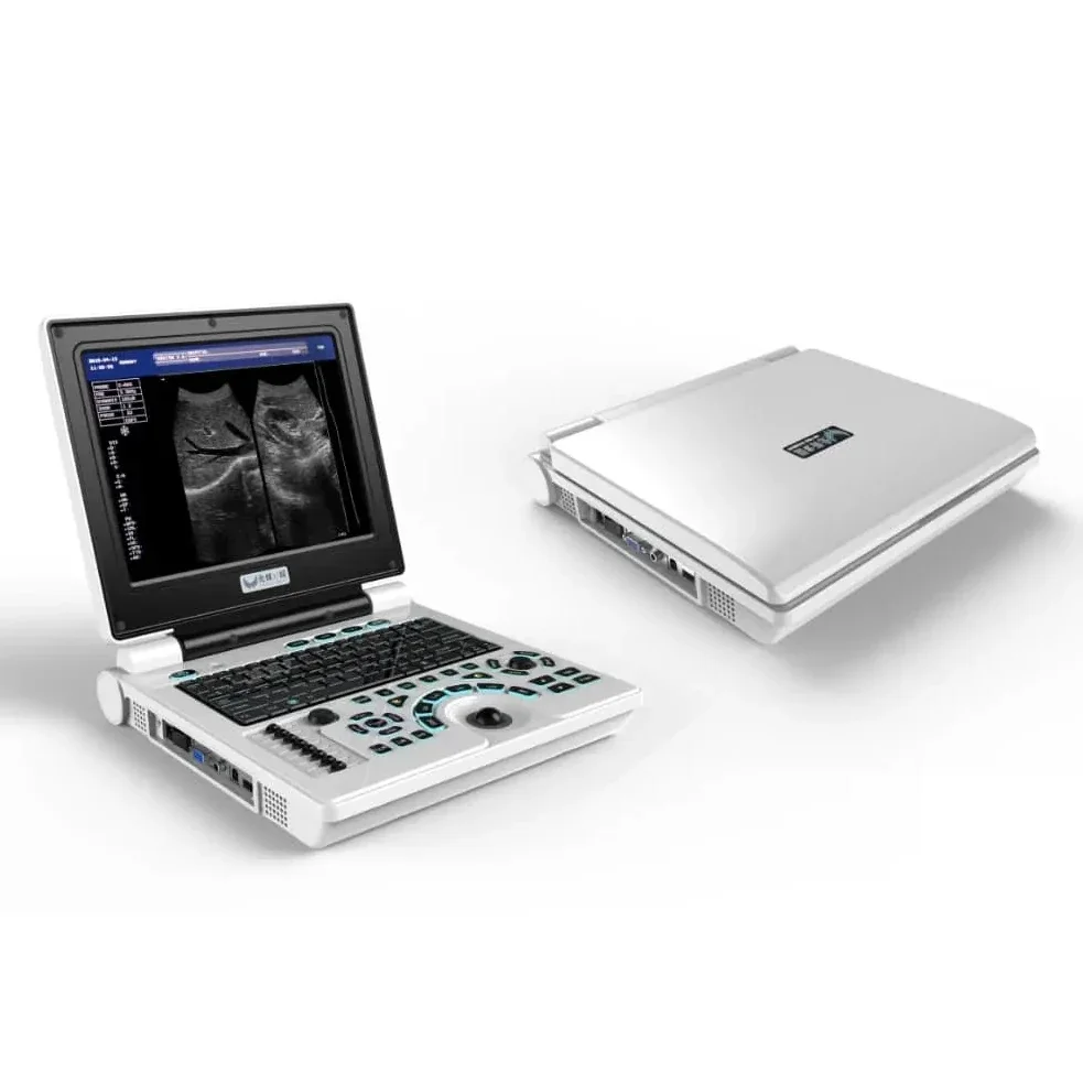 Ультразвуковые диагностические инструменты Портативное ультразвуковое