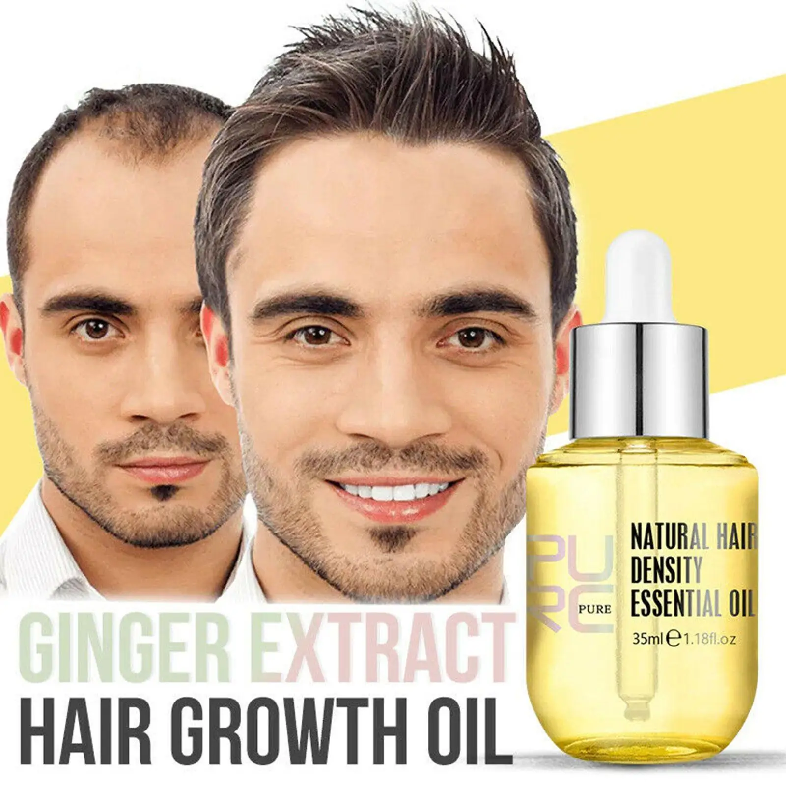 

35ml Free shipping Ginger Essence For Hair Growth Oil Men Women Thickening Grow Hair Treatment Products Dropshipping Hot J8D3