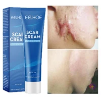 herbal scar removal cream treatment surgical scar stretch marks repair gel remove acne spots burn pigmentation smooth skin care