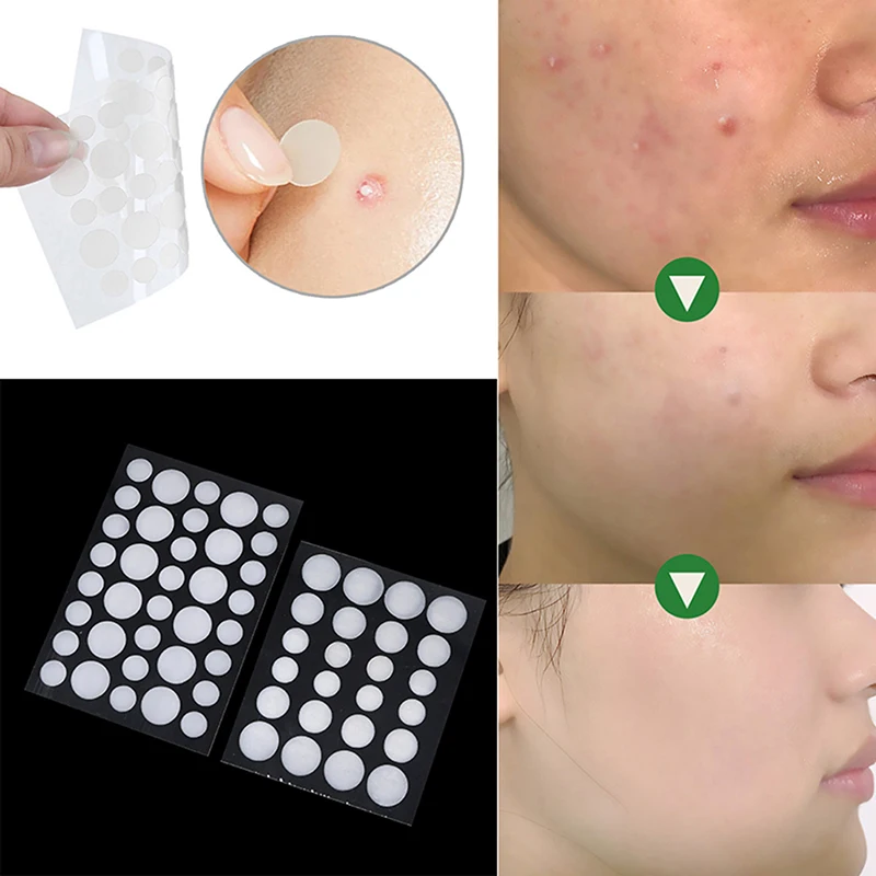 

24/36 пластырей, патчи от прыщей и акне, невидимые наклейки для лица, лечение, удаление, патчи, инструменты для красоты, уход за кожей лица