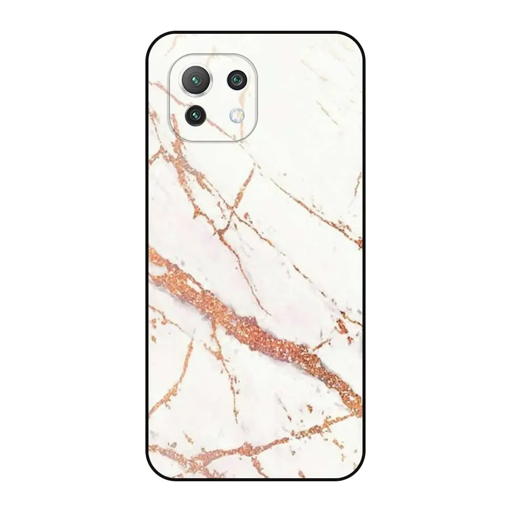 Защитные сумки для телефона дешевый мужской чехол Xiaomi Mi 11 6 81 дюйма мягкий кожа