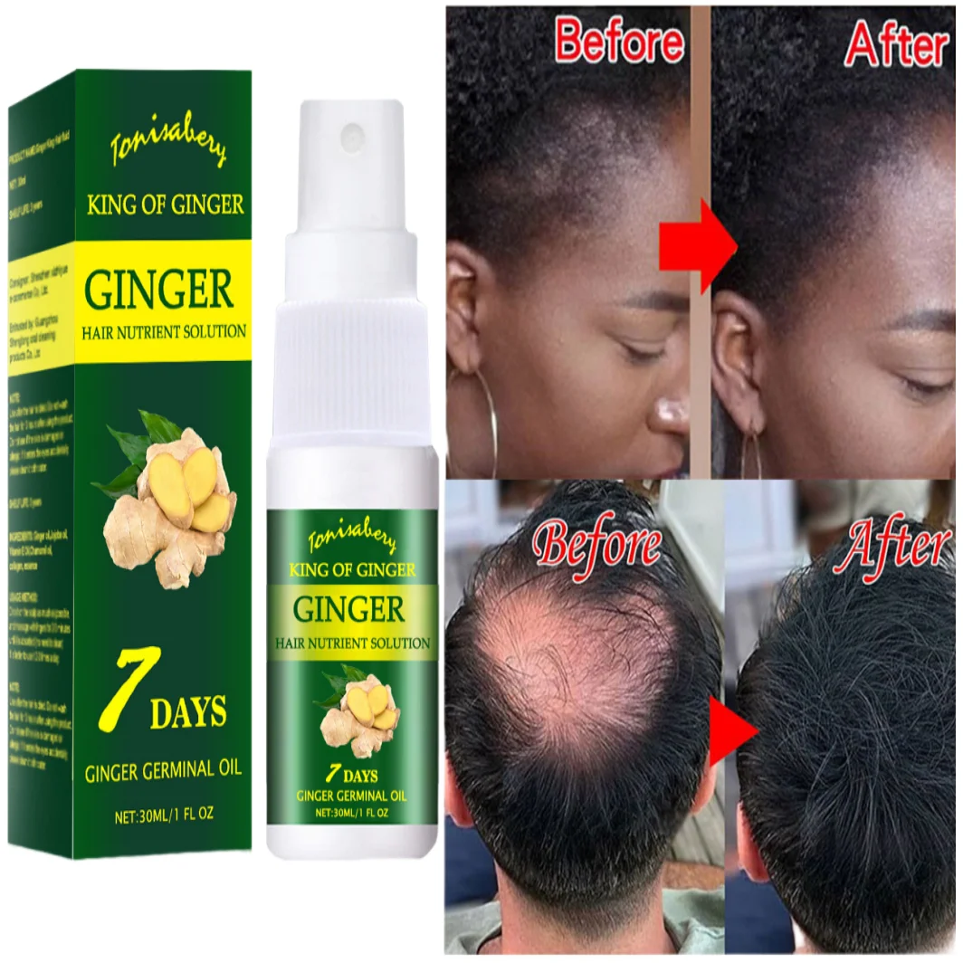 Instant Hair Growth Spray Anti-Baldness Treatment Hair Regrowth Serum Hair Loss Prevent Essence Hair Thinning Treatment Liquid