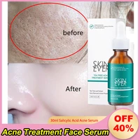 salicylic acid acne treatment face serum oil contro whitening shrink pores remove blackheads essence korean cosmetics skin care