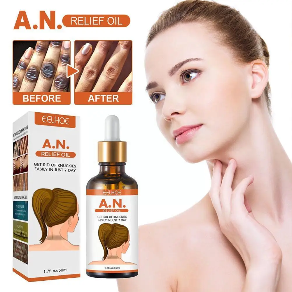 

Gfouk Acanthosis Nigricans Therapy Oil, Dark Spot Corrector Oil, Dark Knuckle Whitening Serum, for Removing Dark Knuckle El J5W1