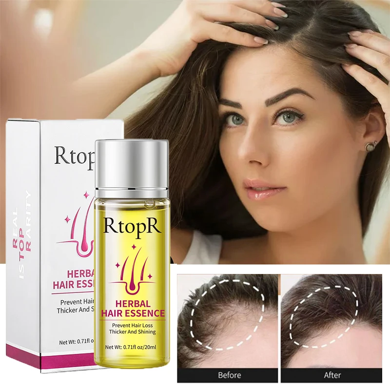 

Hair Growth Serum Prevent Hair Loss Treatment Fast Growing Thicker Repair Dry Frizzy Damaged Scalp Nourishing Essence Hair Care