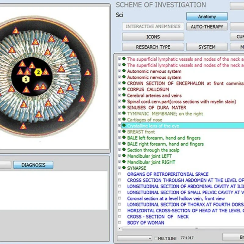 Новейший анализатор здоровья 12d nls аппарат для проверки aura