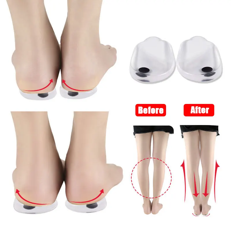 

Silicone Orthopedic Insoles for Feet O/X Leg Type Valgus Varus Correction Plantar Fasciitis Gel Insole Magnet Massage Foot Care