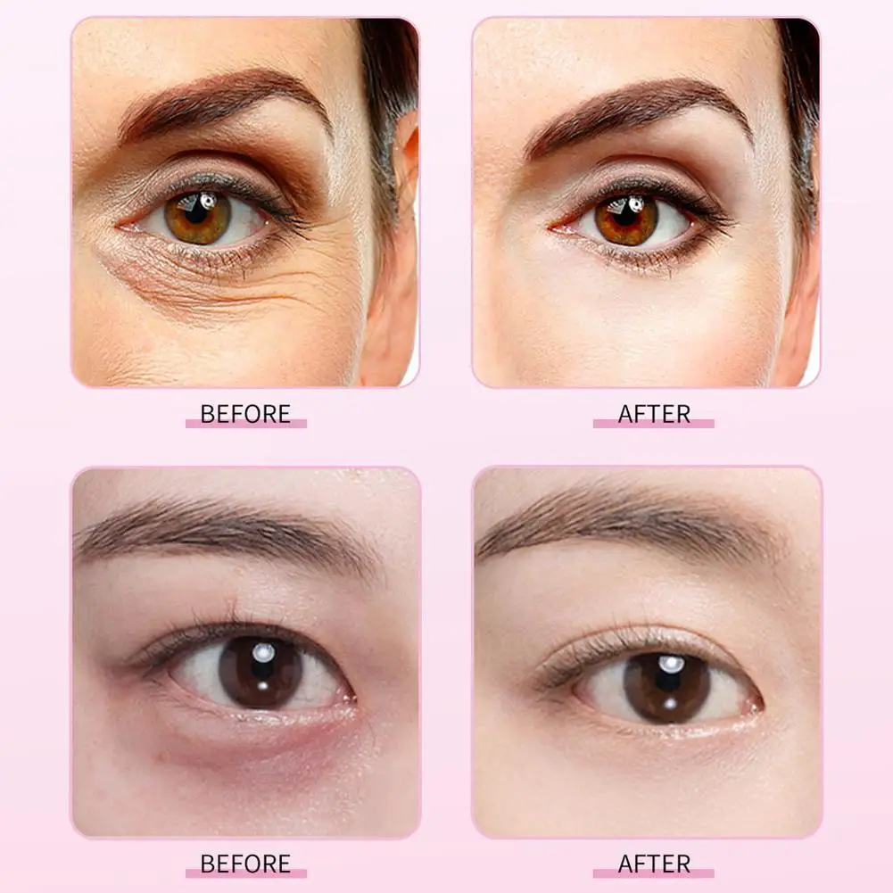 Рисунок 6 - Крем для области вокруг глаз