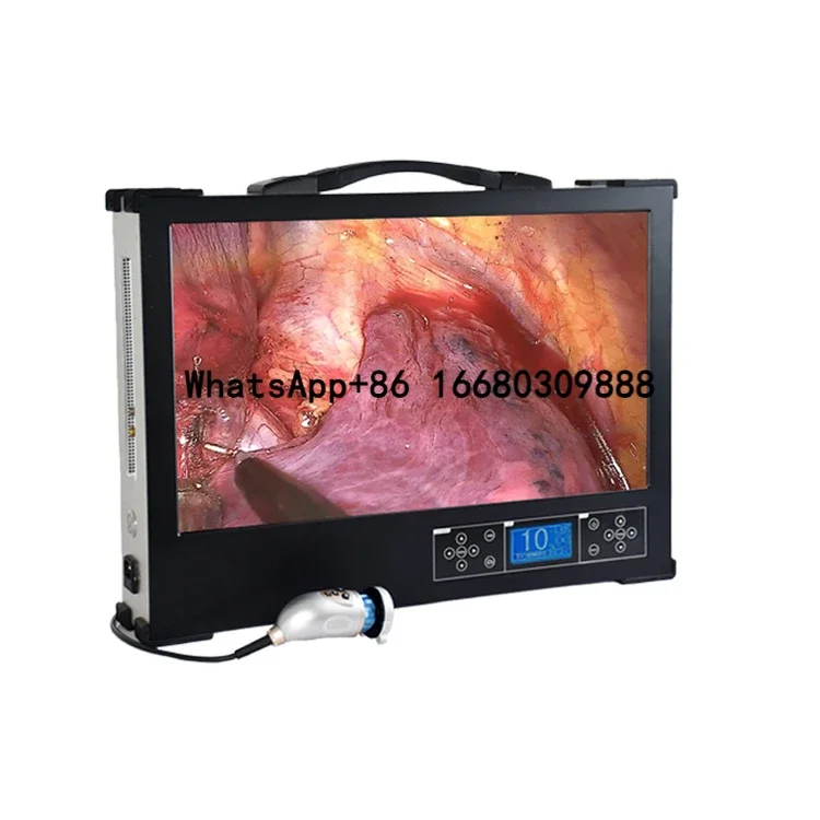 24-дюймовый медицинский встроенный эндоскоп ультразвуковое и электронное