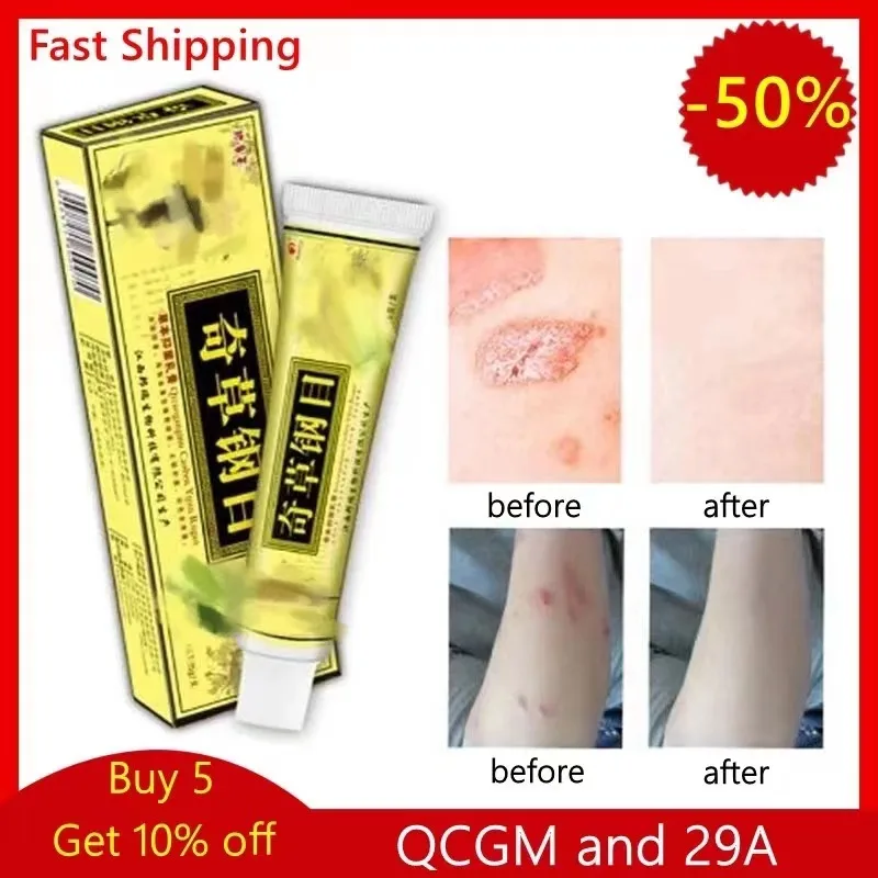 

2Pcs Skin Cream for Psoriasis, Dermatitis, Eczematoid,Ointment,Thailand 29A Psoriasis Treatment Cream